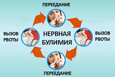 Лечение булимии в Никольске
